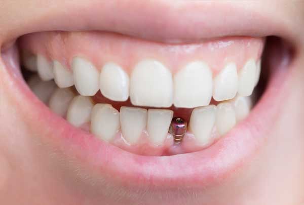 Meher Health & Dental Care
