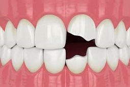 Meher Health & Dental Care